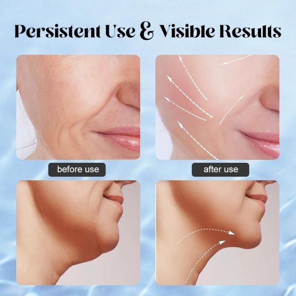 Massager For Face Lifting Facial Massagers Ems Neck Eye Massage Instrument Vibrator Microcurrents Red Light Therapy Anti Wrinkle – Random Color