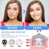 Es-1081 Massager Intense Pulsed Light Wrinkles Reducing Instrument – Esx – Anti Ageing & Reduces Puffiness | Face Massager For Fine Line & Wrinkles – Random Color