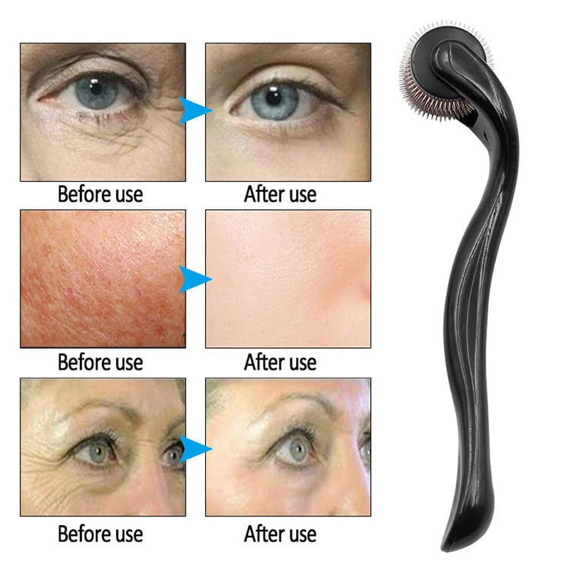 540 Derma Roller – Microneedle Roller for Hair Growth, Beard Care & Facial Skin Rejuvenation